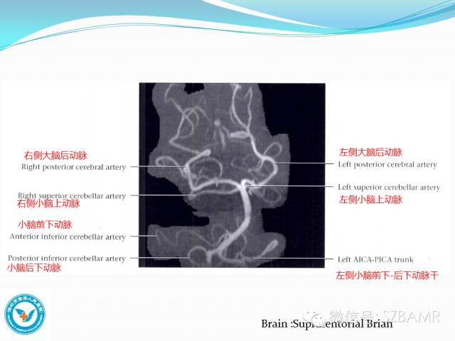 椎-基底动脉系统ct,mr及dsa影像解剖