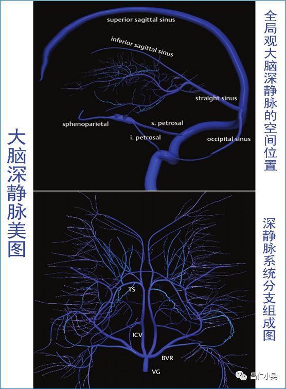 解剖学习笔记 | 脑静脉