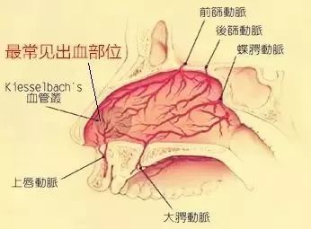 什么毒药会让人口鼻出血_兰博基尼毒药