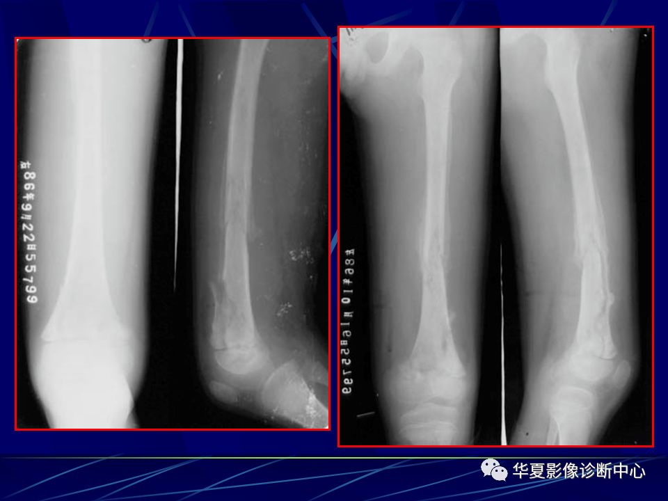 作者:汕头大学医学院第一附属医院放射学教研室柯维旭老师,感谢!