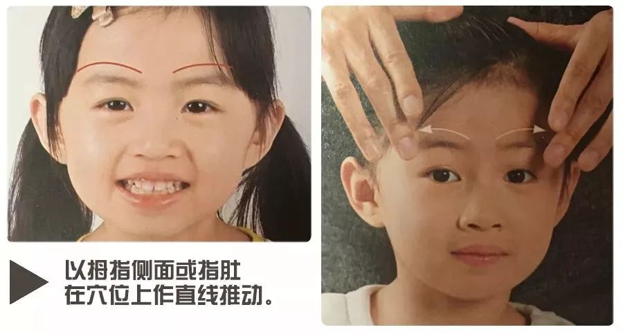 小孩长麦粒肿怎么办