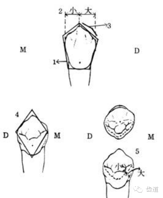 各个牙体雕刻之基本形态要求