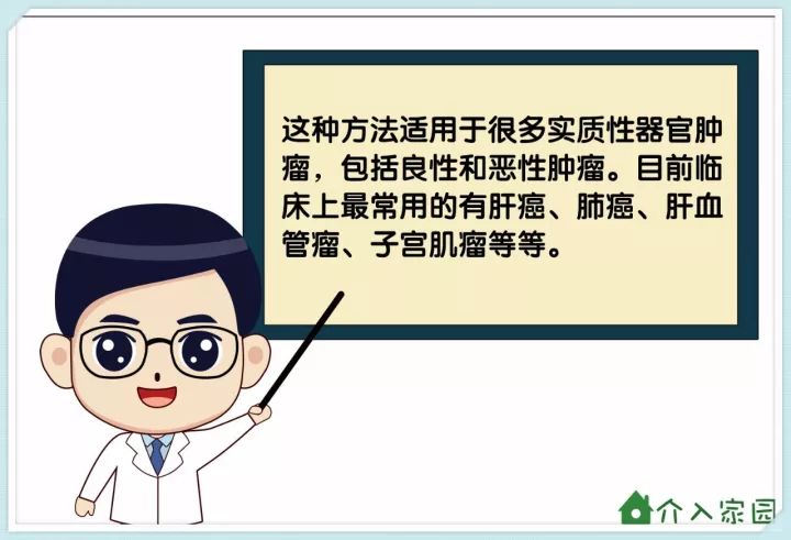 介入医生是做什么的?