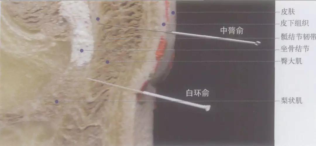 白环俞穴:调经止带,固肾益精,通利小便