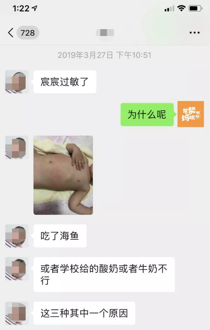 小孩过敏全身痒怎么办