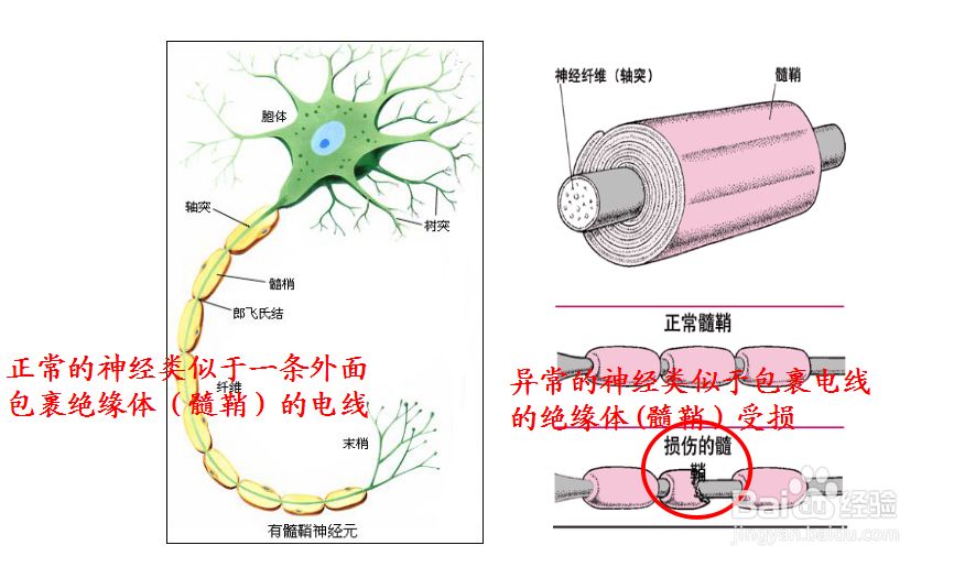 以滋养人体的五脏六腑为主,逐渐修复人体受损髓鞘,保护神经元及轴突