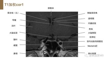 磁共振片子怎么看脑垂体