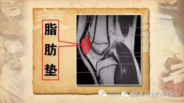 筋抻到了怎么办