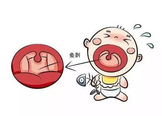                     宝宝卡鱼刺怎么办？妈妈急救做好这2点，喝醋就是小儿科