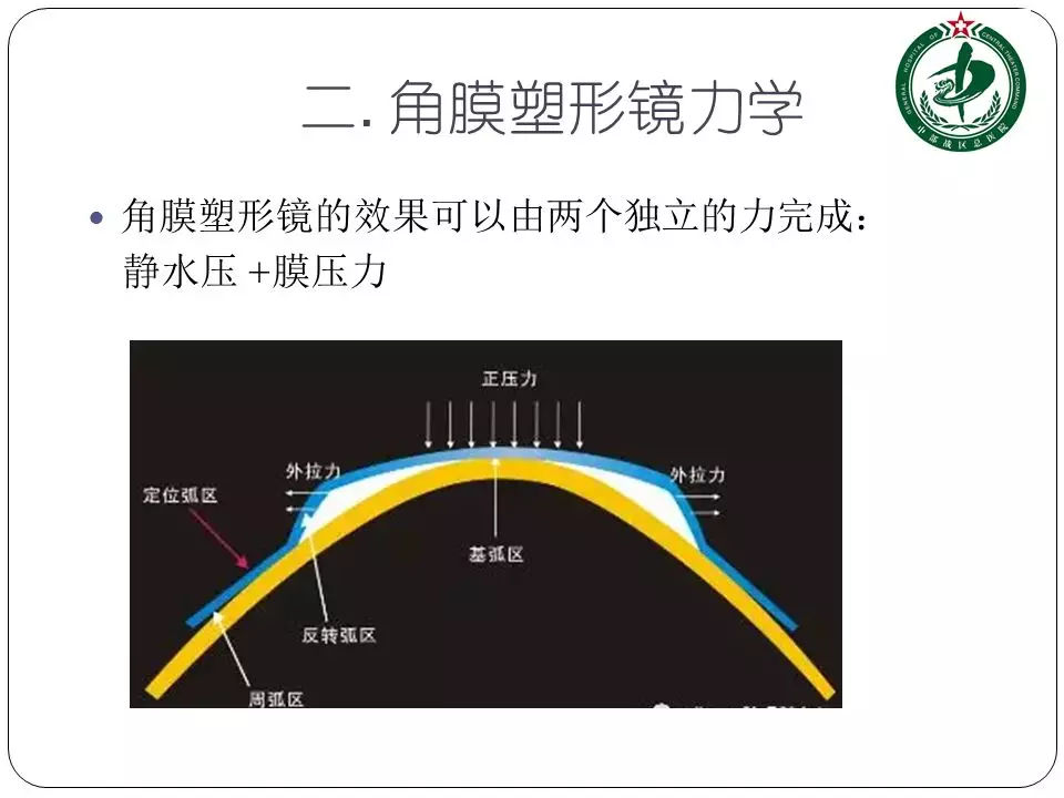 塑形镜的原理_△角膜塑形镜视力矫正原理