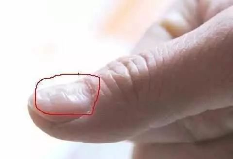 苹果加什么可以治胃病 4736b82823a24c769172e4143745c47f.jpeg