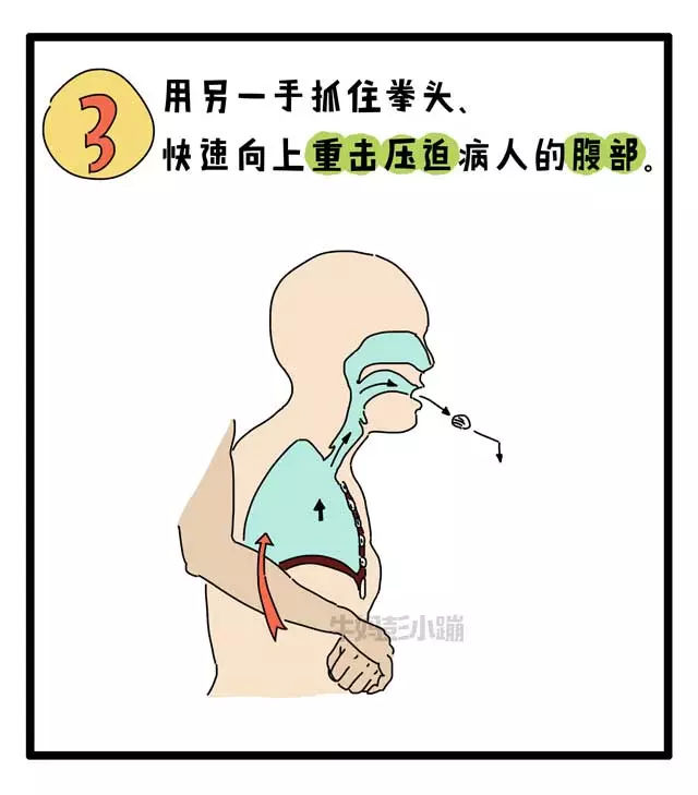 四岁幼童噎食8分钟去世,这套急救图建议打印出来