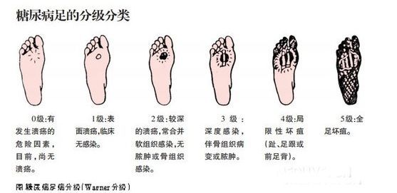 老年人口痒_重庆老年人口数据图(2)