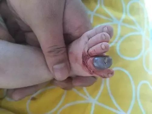                     又一女宝呛奶夭折，就因为新手妈妈少做了一个动作