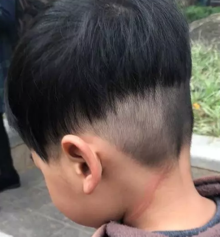                     钧钧妈分享：4月放风筝警告！不要让风筝线成了孩子的“割喉绳”！