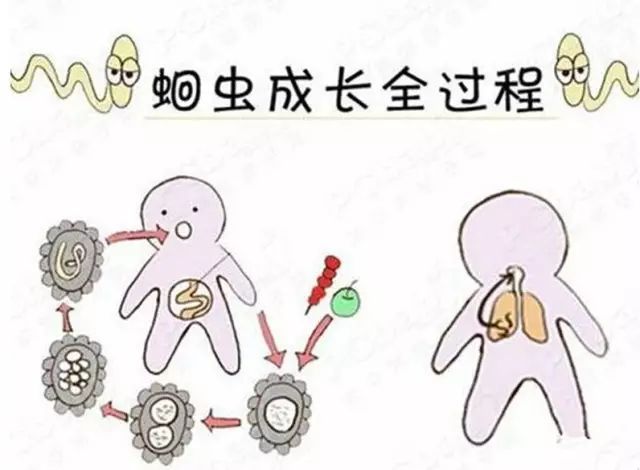 打虫重在防警惕寄生虫危害宝宝健康