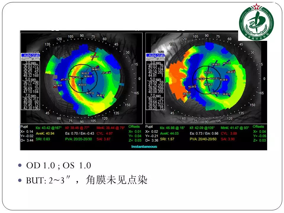 OD体育官方网站- OD体育APP下载- 世界杯指定投注平台车上的sport按键是什么意思