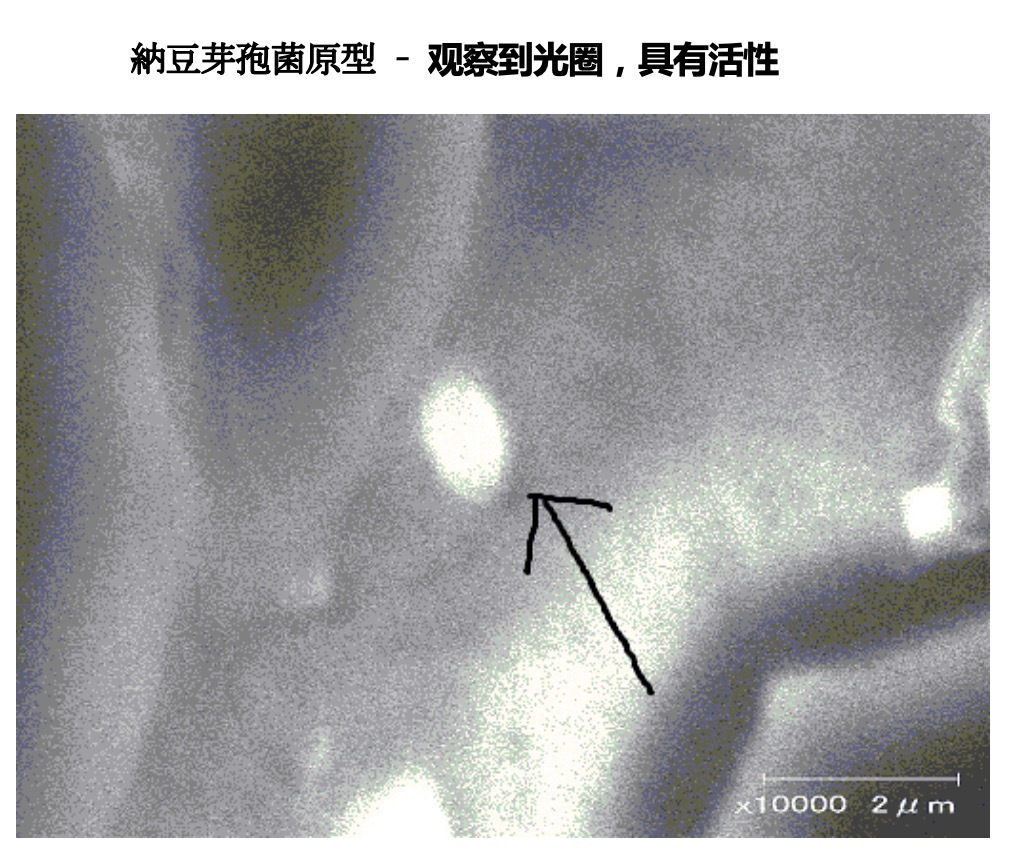 超级真菌耳道假丝酵母菌在日本被发现为什么没有在日本散播开