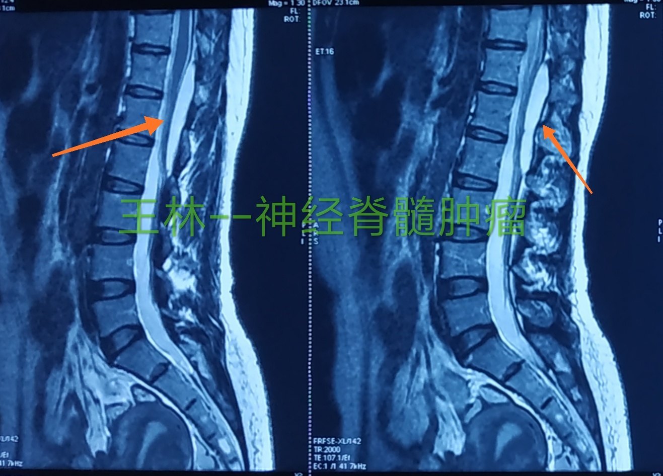 头部核磁忘了脱内衣_头部核磁(3)