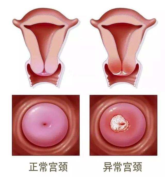 认为黑洞长得像宫颈的请举手