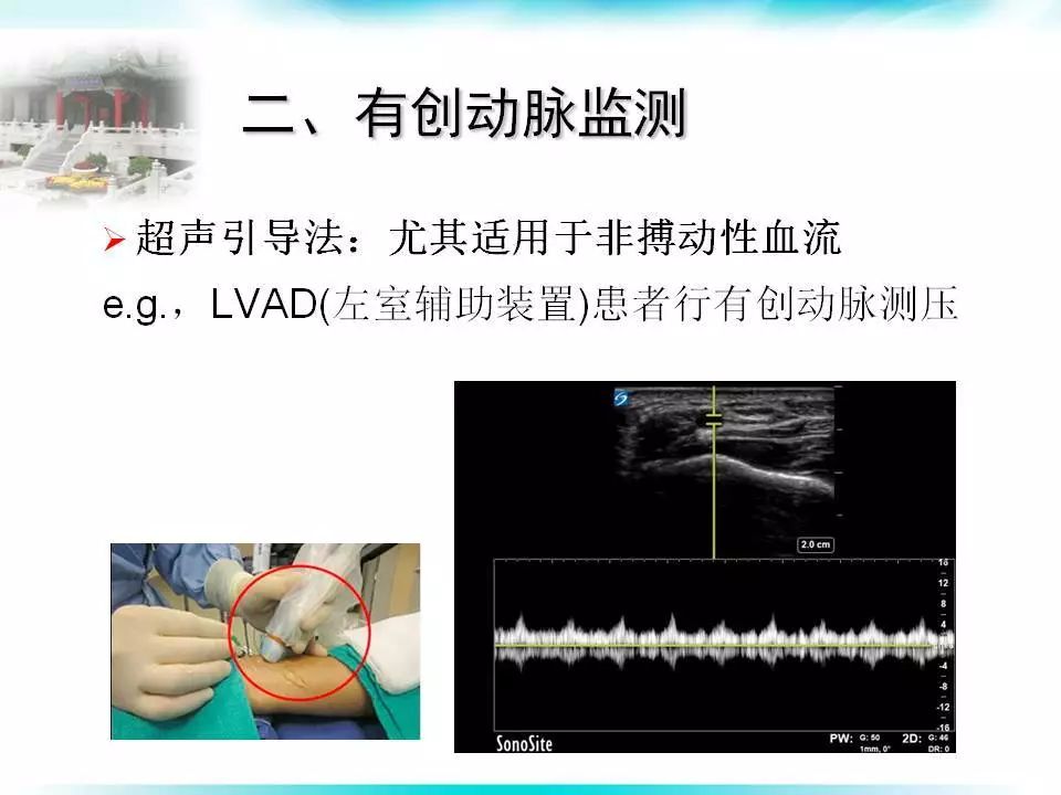 术中须进行多次血气分析以及无法进行无创动脉压监测者,术中往往需要