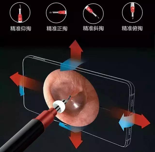 掏耳朵黑科技掏出了颅内高cháo边看边掏耳垢一览无余