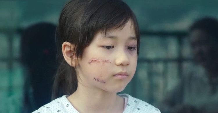 素媛脸上的伤怎么来的韩国电影也不敢拍出来