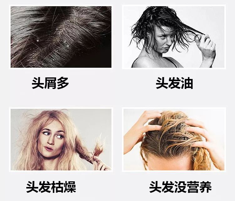 柔润洗发护发系列:一支洗,一支养,一支护,一步到位解决你的头发问题.