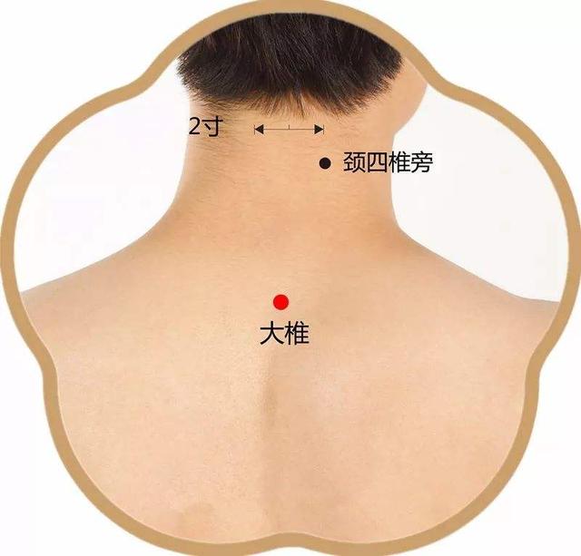 2,肩中俞穴 第1步:坐位低头或俯伏位; 第2步:在后正中线上,可见颈