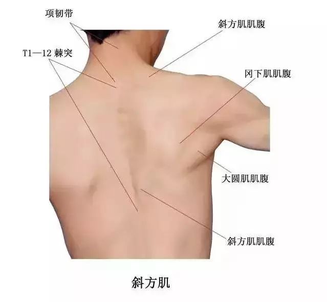 斜方肌部位:斜方肌位于项部和背上部,一侧自项胸部正中线向肩峰伸展