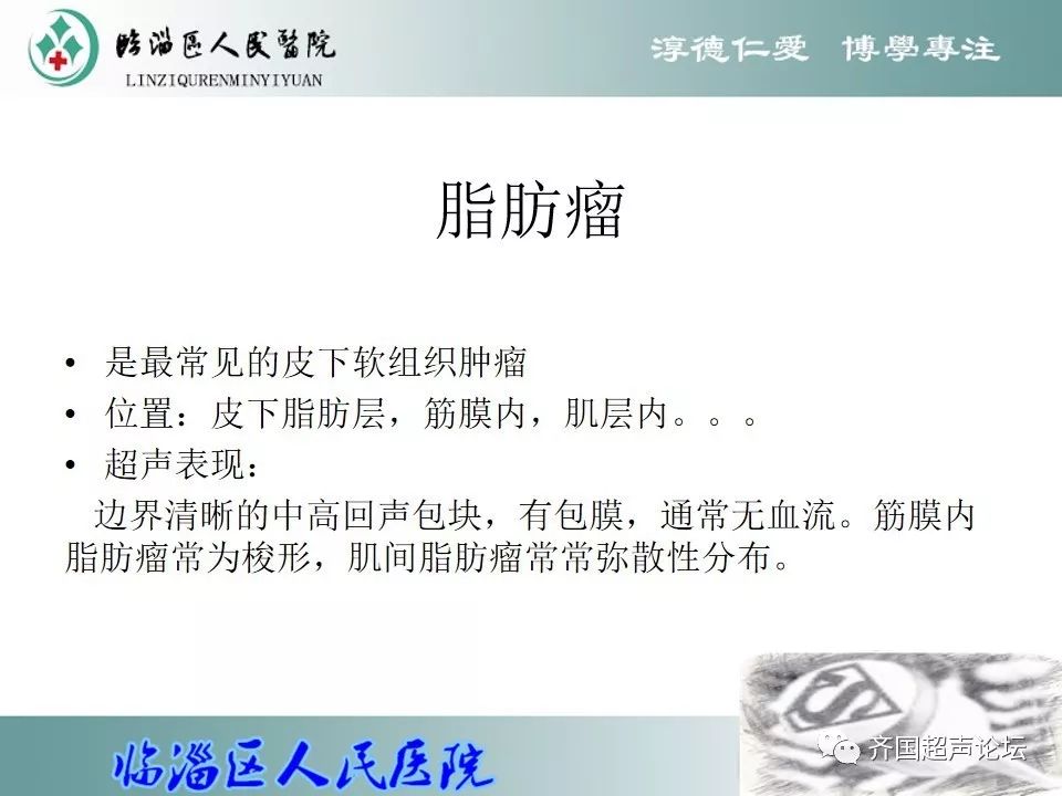 【基础】超声之浅表组织肿瘤_肿物