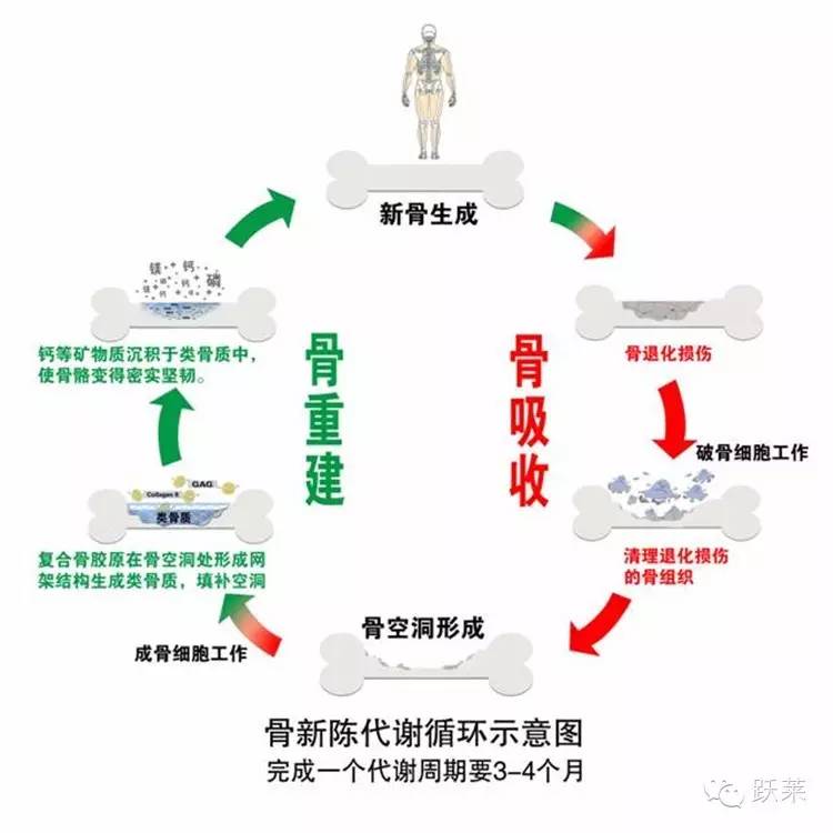 骨质疏松症,糖友你注意了吗?