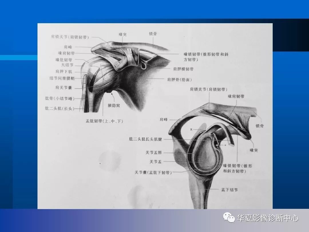 【影像基础】肩关节的影像解剖与mri(附关节实物图)