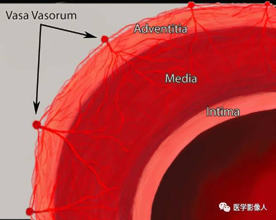 主动脉壁内血肿影像学新概念附结构式报告模板