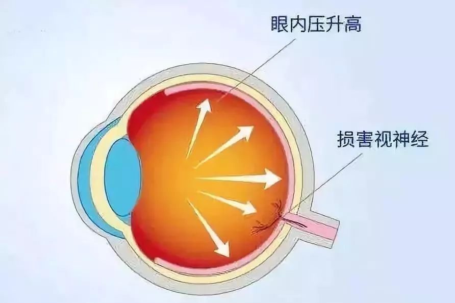 流入的房水为眼睛带来必需的养料,流出的房水带走代谢后的废物.