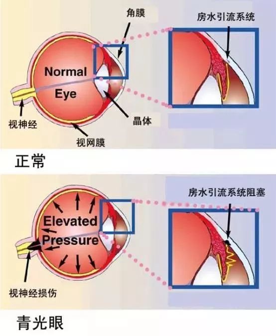 其实,我们眼球里面的水并不是一滩"死水,而是一汪不断有房水流入和