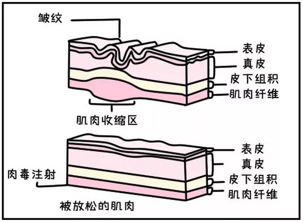 斜视的原理_什么是斜视 内斜视 外斜视 斜视的症状有哪些