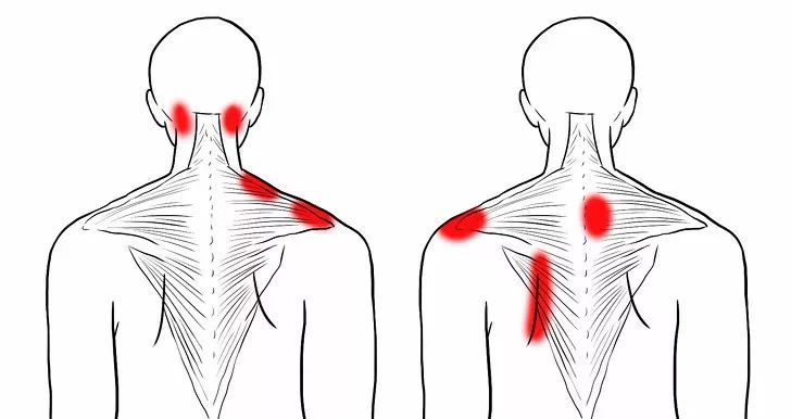 肩颈疼痛,10张精准拉伸解剖图