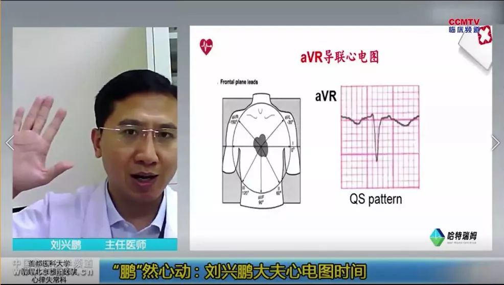 avr导联提示什么?