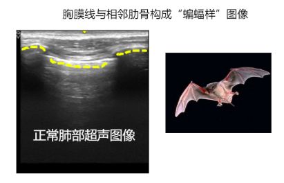 人口肺又称_人口普查