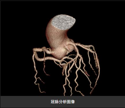 4月20日(本周六)邀请北京专家来我院会诊,需做冠脉cta患者提前预约