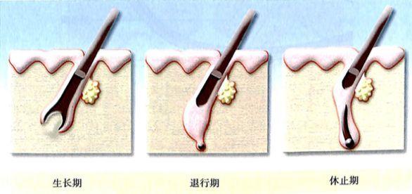 颜料长毛怎么办