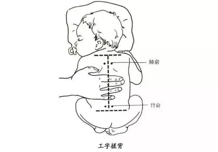 工字搓背,增强宝宝抵抗力,儿童家庭保健必备-哈尔滨小儿推拿培训