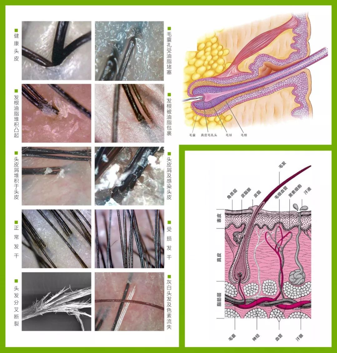 青白色 | 健康头皮 ● 黄色 | 疲劳,代谢不良,毛孔阻塞,常见于