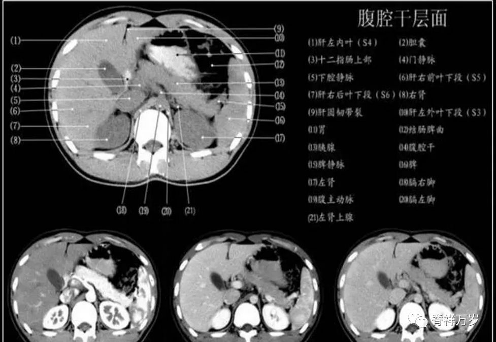 腹腔干层面