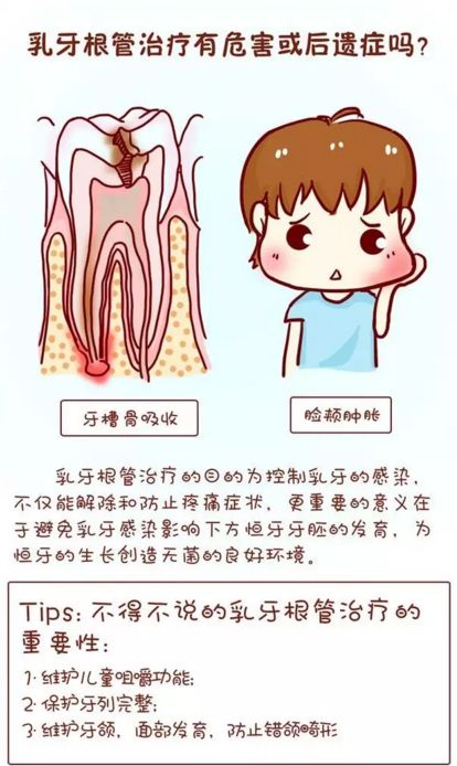 宝宝的乳牙应不应该做根管治疗?