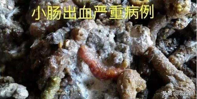 肠毒综合症