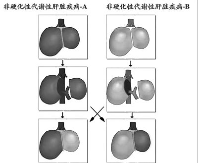 器官移植是什么原理_器官移植图片