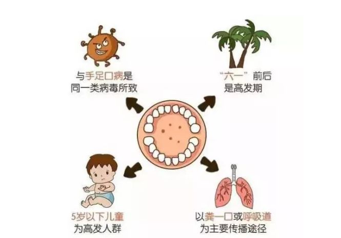 疱疹性咽峡炎的症状与手足口病都属于肠道病毒感染引起的出疹性疾病