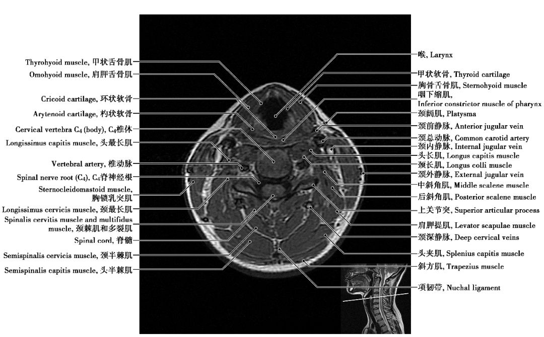 中枢神经系统影像解剖图谱连载2颈椎mri概论t1wi轴位解剖图